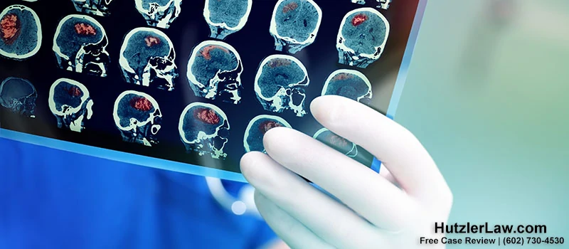 How Many Types of Brain Injuries Are There?