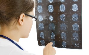 How long does a brain injury claim take?